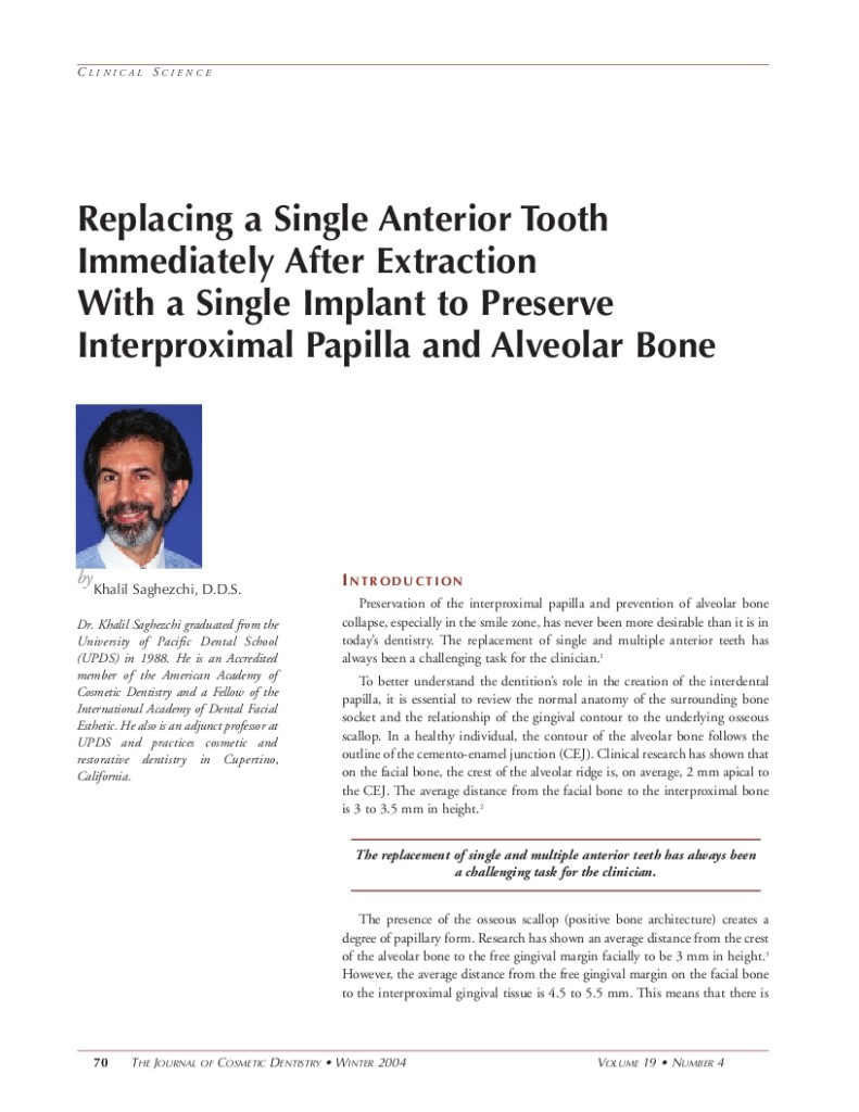 Replacing A Single Tooth 1